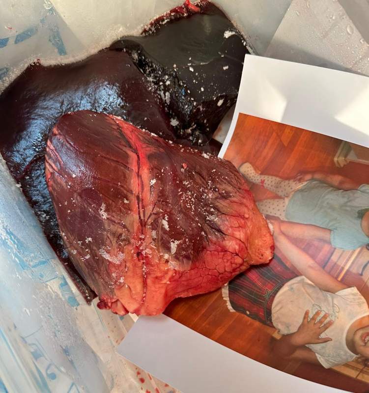 Полиция Астаны проводит расследование по факту доставки органов в коробке в редакцию Ulysmedia