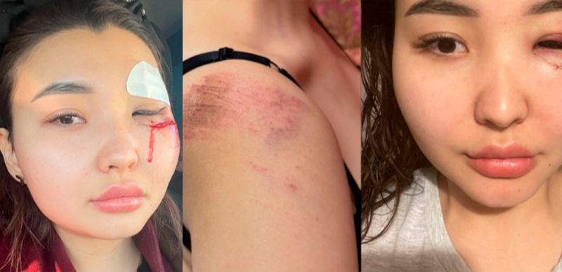 Вывезли на кладбище и избили. Блогер из Атырау пожаловалась на предвзятость полиции